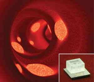 Fig. 1: The endothelial progenitor cell detection chip (inset) could be used in the assessment of plaque build-up in blood vessels (main image).