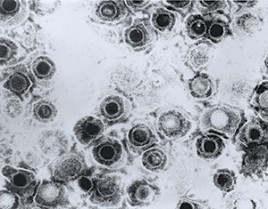 Herpes simplex virus 1 (shown here under transmission electron microscopy) causes cold sores and is very common in humans.