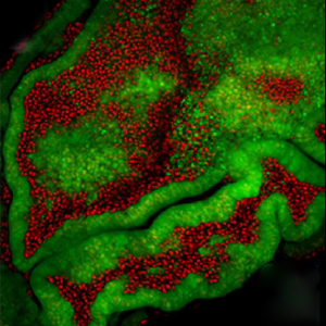 Microscope image of an imaginal disc of a developing fruit fly.