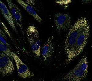 Confocal images of quantum dots localized within colon cells can guide the development of innovative drug delivery formulations.