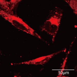 Magnetic, pH-responsive nanoparticles deliver the antitumor drug doxorubicin (fluorescing red in this image) to cancer cells