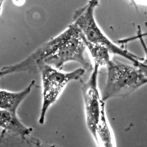 Brain-specific vascular smooth muscle cells.