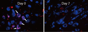 Blood vessel cells are capable of clearing amyloid-beta proteins (red), which are transported to organelles (blue) for enzymatic degradation.