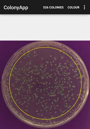 Using a watershed algorithm, the APD Colony Counter App developed by A*STAR researchers can cheaply count the bacterial colonies on a culture plate on-the-go.