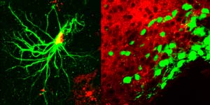 A magnified view of a region of the hypothalamus showing astrocytes in red and NPY neurons in green.