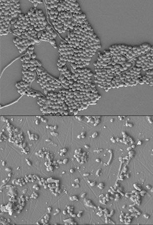 A Candida albicans biofilm before (top) and after (bottom) treatment with one of the synthetic peptides.