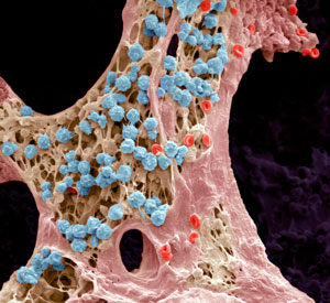 Bone marrow (shown above) is the site of blood cell production, including white blood cells (blue). An A*STAR group has looked at bone marrow and found two distinct subpopulations of monocytes, a type of infection-fighting white blood cell.