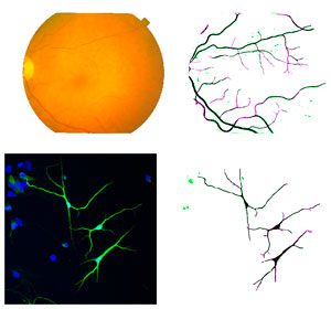 Retinal and neuronal segmentation images (right column) can be produced from empirical two-dimensional datasets (left column) thanks to a new computational approach.