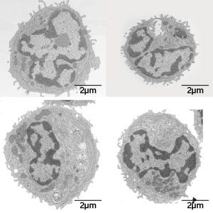 Electronic microscopy images of pre-DCs (top) and pDCs (bottom).