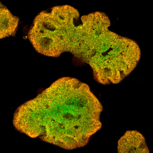 Pancreatic stem cells that could aid diabetes research.