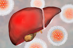 Persistent inflammation in the liver in chronic viral hepatitis has been only partially explained, but these findings show that gut bacteria causes pro-inflammatory immune cells to accumulate in the liver.