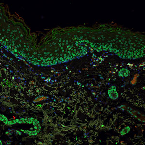 Lamin B1 stained green in human skin cells.