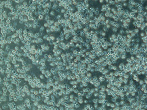 A novel method to generate natural killer cells from peripheral blood cell-derived stem cells may transform immunotherapies for different cancers.