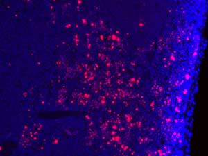 DNA damage (red) in the spleen of a mouse that expresses the mutant form of CDK1 that cannot be suppressed by phosphorylation.