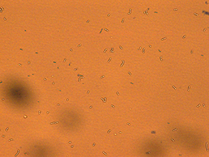 A mutant bacterial strain of Lactobacillus pentosus, which has an elevated tolerance to acid, may lead to cheaper lactic acid production.