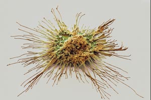 Dendritic cells, so named because of their branch-like appendages, identify foreign invaders and cancer cells in the body.