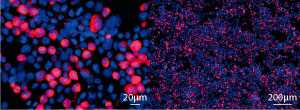 Fluorescent images of immortal cells that can produce antibodies (red).